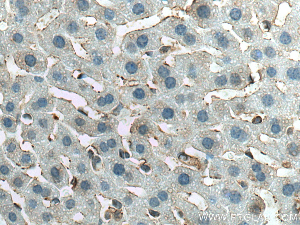 Immunohistochemistry (IHC) staining of mouse liver tissue using ANO6 Polyclonal antibody (20784-1-AP)