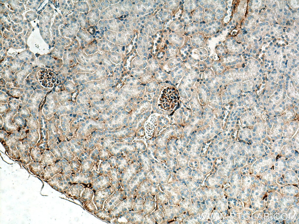 Immunohistochemistry (IHC) staining of mouse kidney tissue using ANO6 Polyclonal antibody (20784-1-AP)