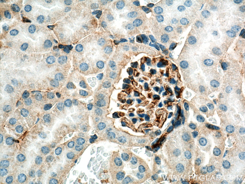 Immunohistochemistry (IHC) staining of mouse kidney tissue using ANO6 Polyclonal antibody (20784-1-AP)
