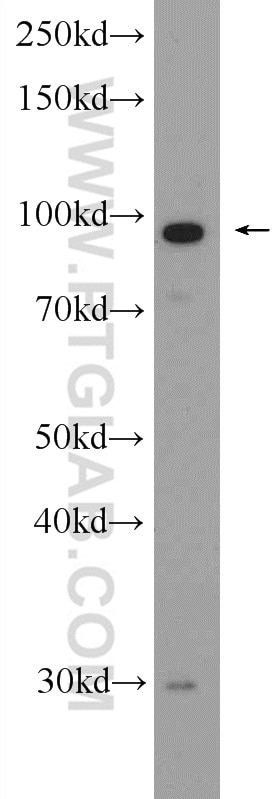 Western Blot (WB) analysis of mouse liver tissue using ANO6 Polyclonal antibody (20784-1-AP)