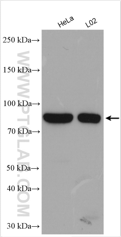 Western Blot (WB) analysis of various lysates using ANO6 Polyclonal antibody (20784-1-AP)