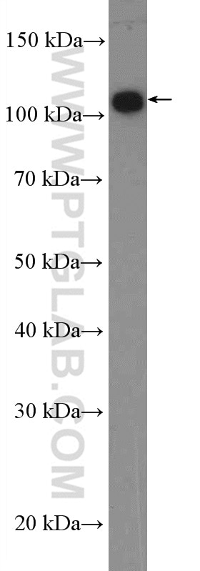 Western Blot (WB) analysis of HEK-293 cells using ANO7 Polyclonal antibody (19486-1-AP)