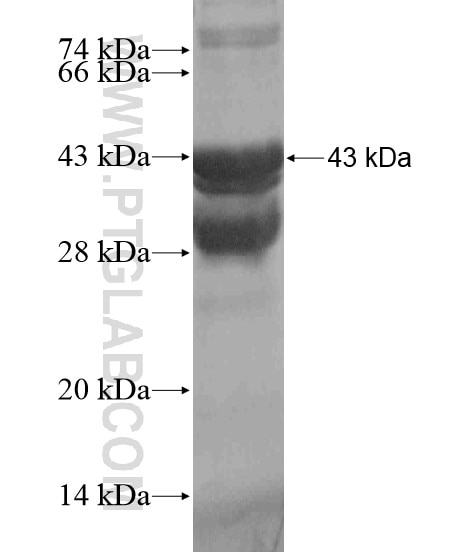 ANO9 fusion protein Ag18941 SDS-PAGE