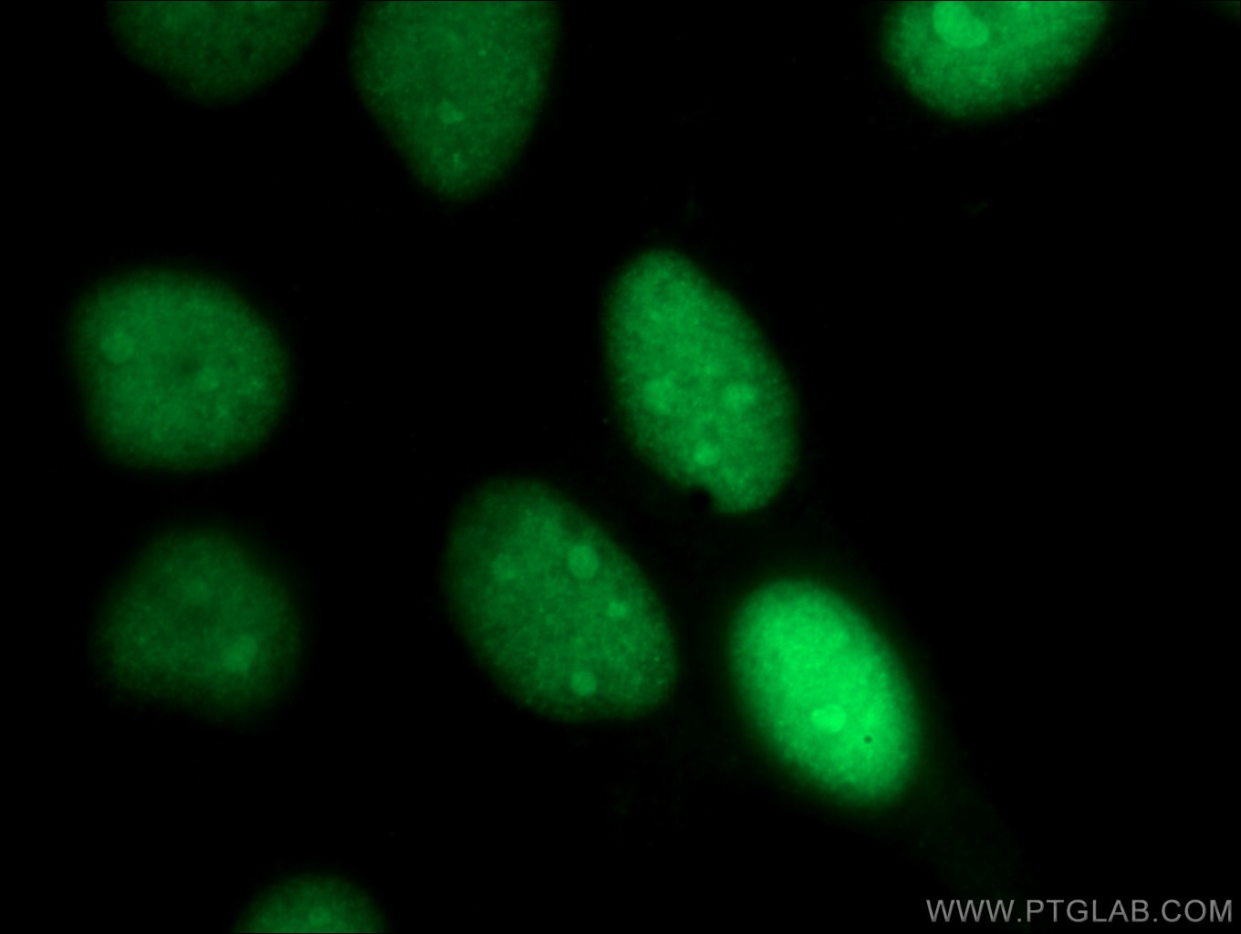 Immunofluorescence (IF) / fluorescent staining of A431 cells using ANP32A Polyclonal antibody (15810-1-AP)