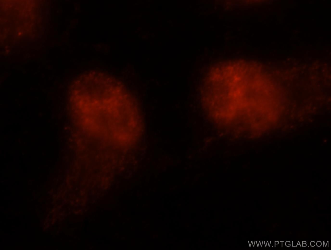 Immunofluorescence (IF) / fluorescent staining of A2780 cells using ANP32A Polyclonal antibody (15810-1-AP)