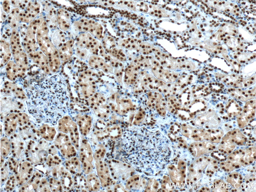 Immunohistochemistry (IHC) staining of human kidney tissue using ANP32A Polyclonal antibody (15810-1-AP)