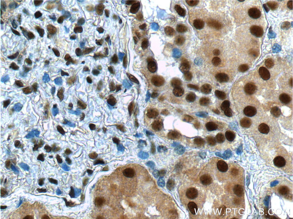 Immunohistochemistry (IHC) staining of human kidney tissue using ANP32A Polyclonal antibody (15810-1-AP)