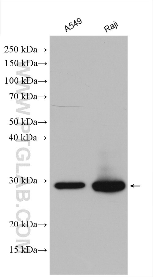 Western Blot (WB) analysis of various lysates using ANP32A Polyclonal antibody (15810-1-AP)