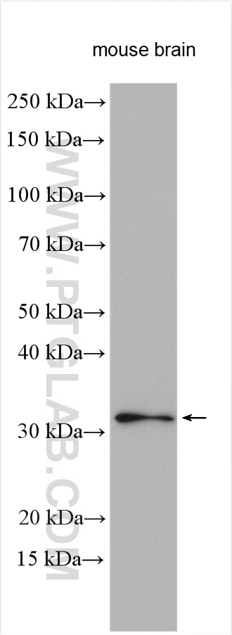 Western Blot (WB) analysis of various lysates using ANP32A Polyclonal antibody (15810-1-AP)