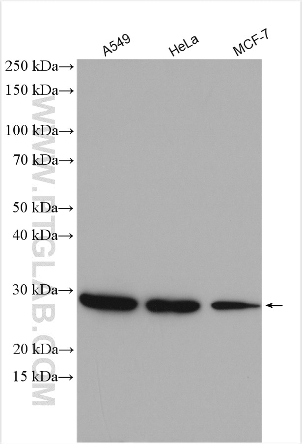 Western Blot (WB) analysis of various lysates using ANP32A Polyclonal antibody (15810-1-AP)