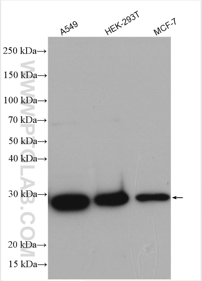 Western Blot (WB) analysis of various lysates using ANP32A Polyclonal antibody (15810-1-AP)