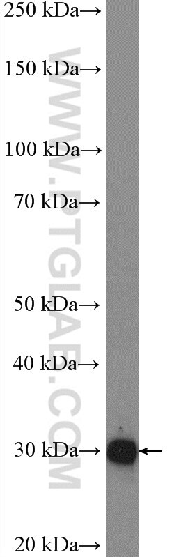 Western Blot (WB) analysis of mouse thymus tissue using ANP32A Polyclonal antibody (15810-1-AP)