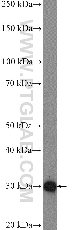 Western Blot (WB) analysis of mouse thymus tissue using ANP32A Polyclonal antibody (15810-1-AP)