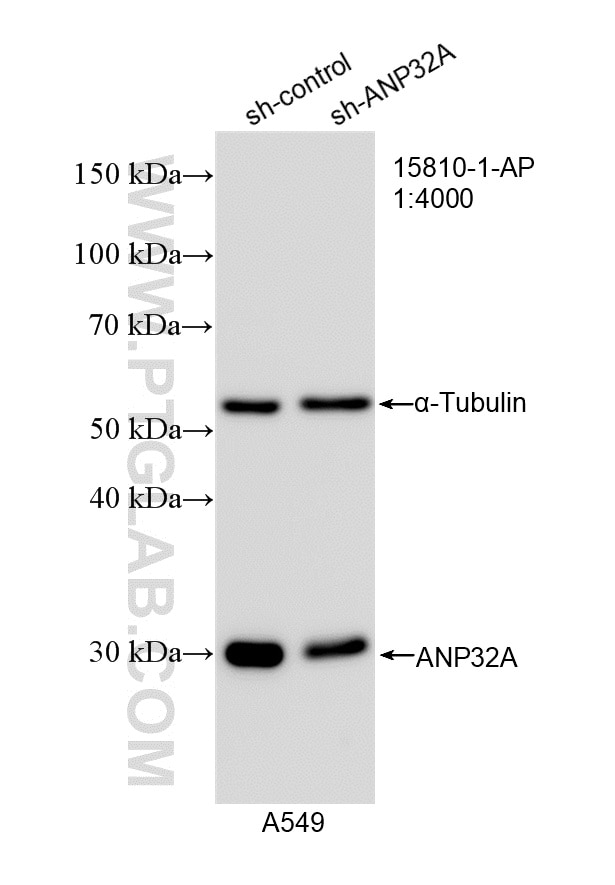 Western Blot (WB) analysis of A549 cells using ANP32A Polyclonal antibody (15810-1-AP)