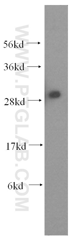 Western Blot (WB) analysis of human brain tissue using ANP32A Polyclonal antibody (15810-1-AP)