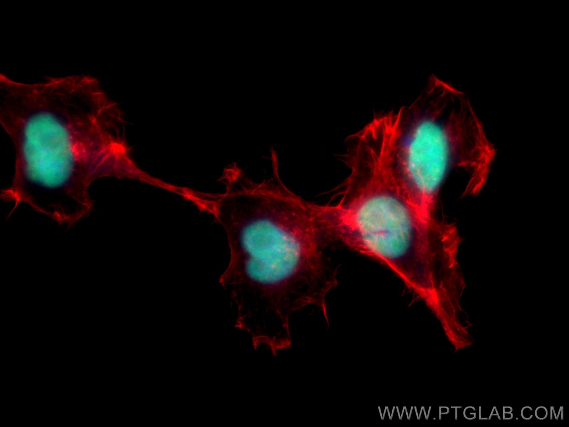 Immunofluorescence (IF) / fluorescent staining of A431 cells using ANP32A Monoclonal antibody (67687-1-Ig)