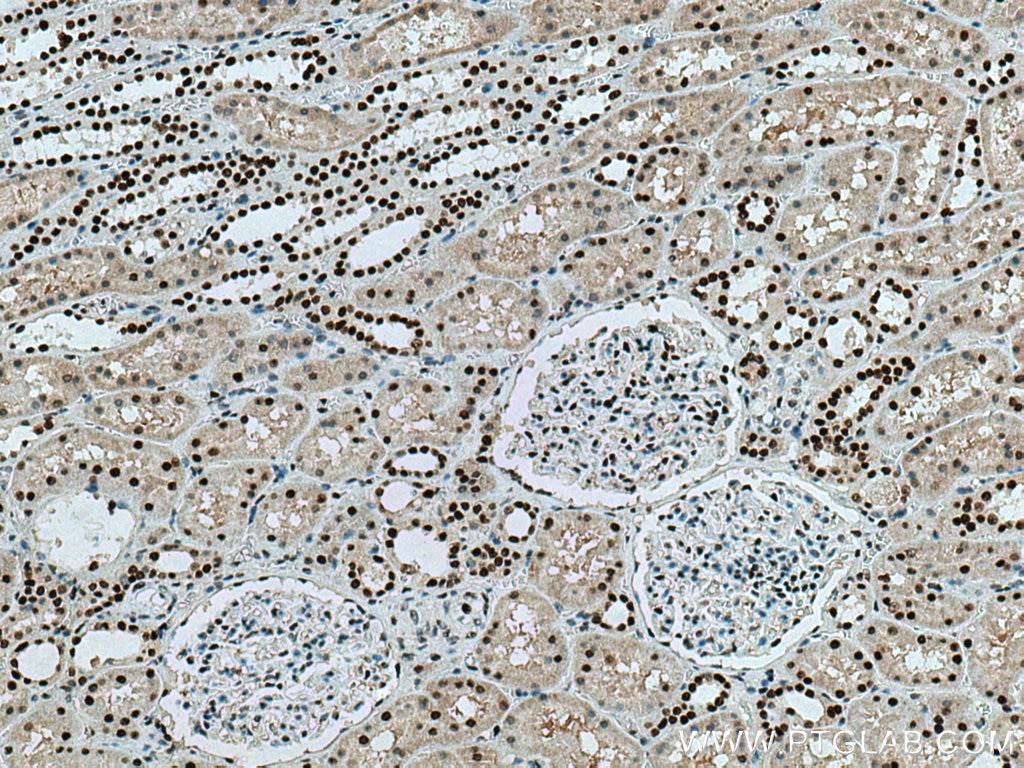 Immunohistochemistry (IHC) staining of human kidney tissue using ANP32A Monoclonal antibody (67687-1-Ig)