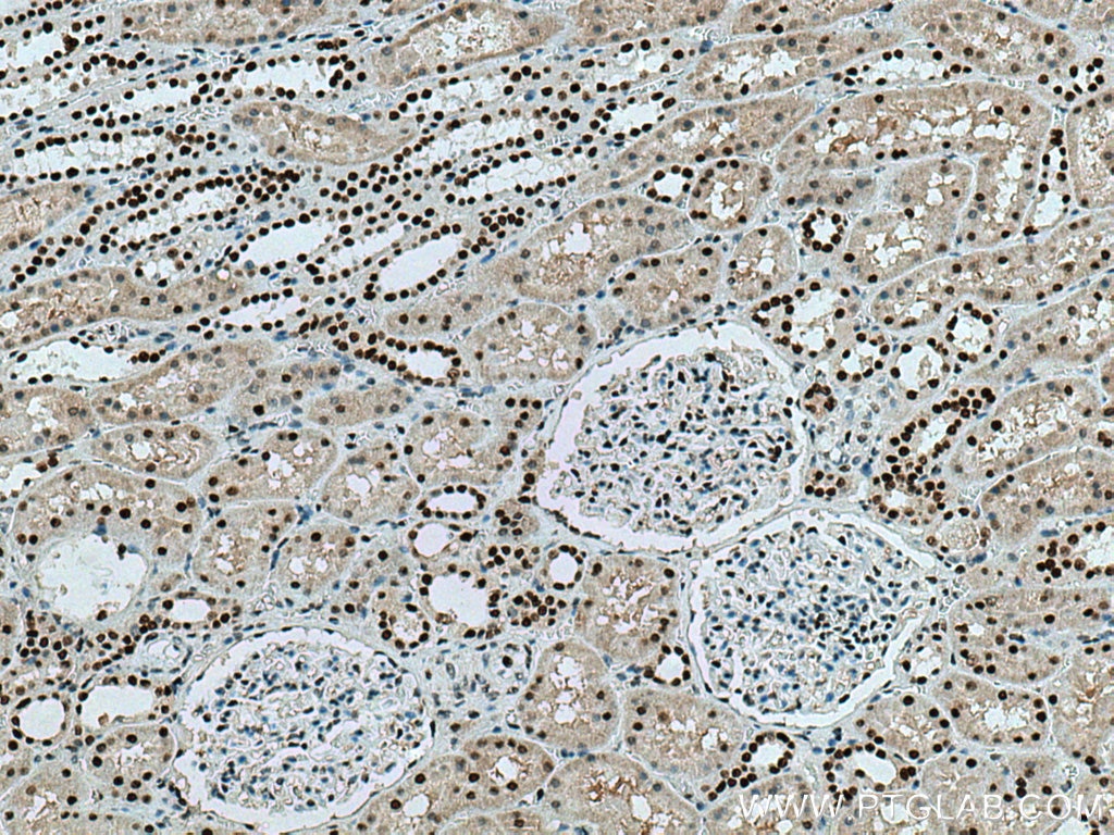 IHC staining of human kidney using 67687-1-Ig