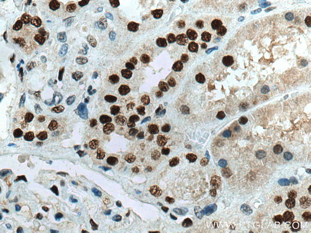 Immunohistochemistry (IHC) staining of human kidney tissue using ANP32A Monoclonal antibody (67687-1-Ig)