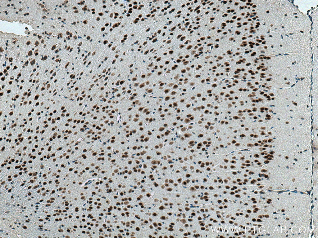 Immunohistochemistry (IHC) staining of mouse brain tissue using ANP32A Monoclonal antibody (67687-1-Ig)