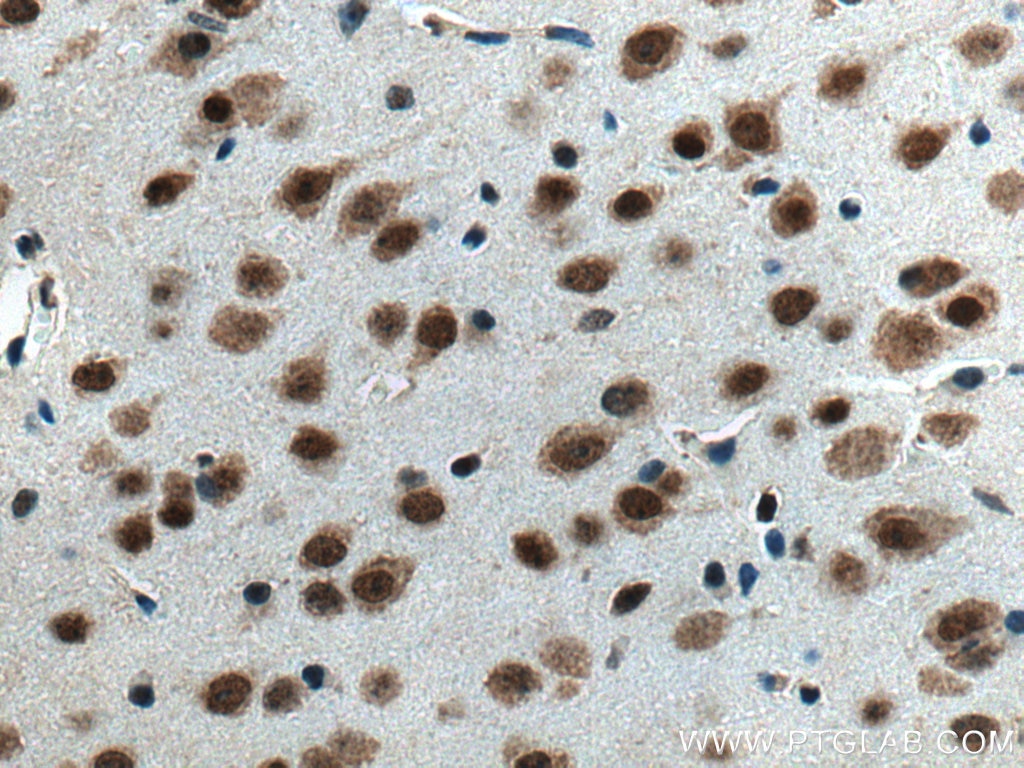 IHC staining of mouse brain using 67687-1-Ig