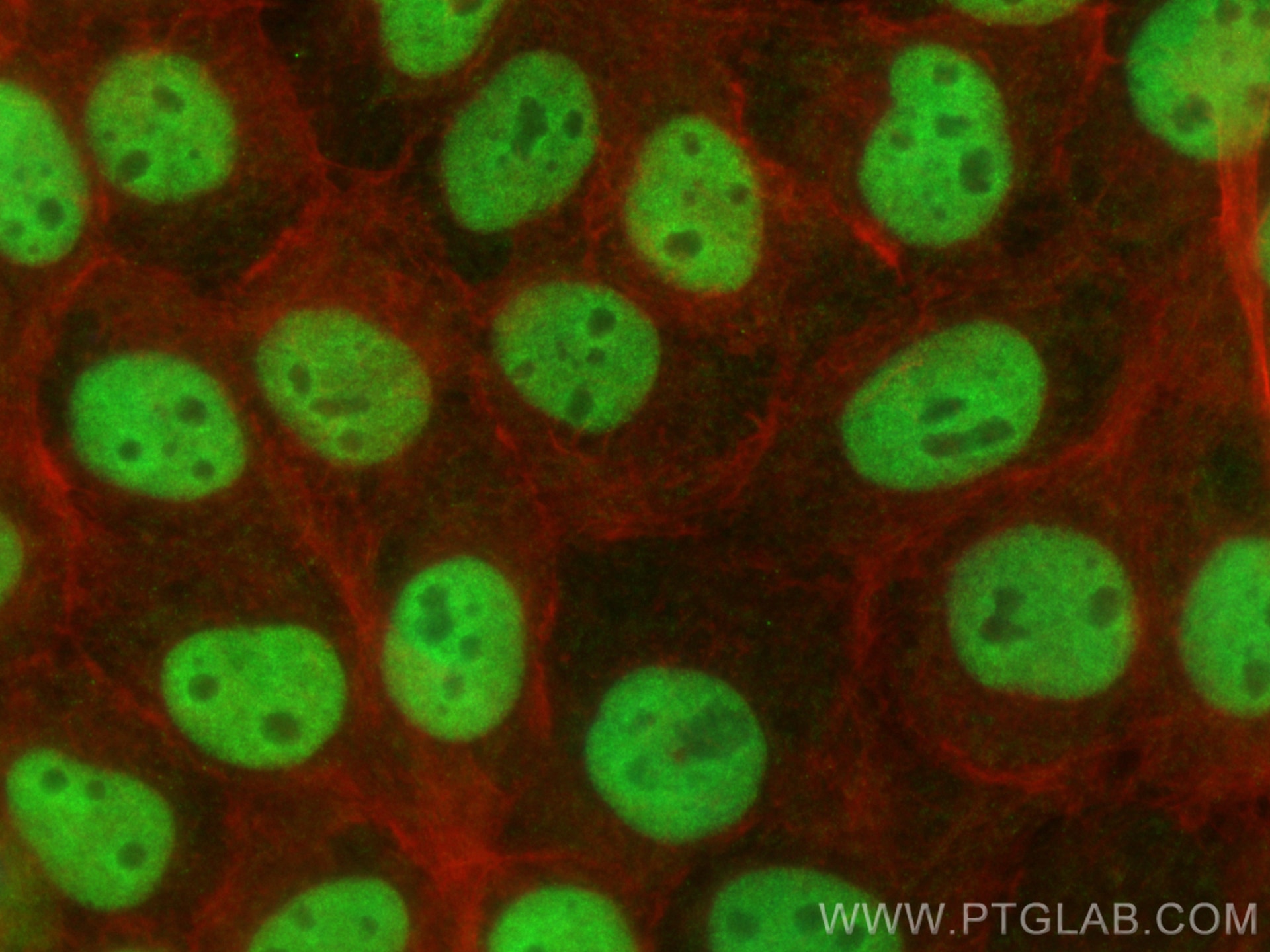 Immunofluorescence (IF) / fluorescent staining of A431 cells using CoraLite® Plus 488-conjugated ANP32A Monoclonal an (CL488-67687)