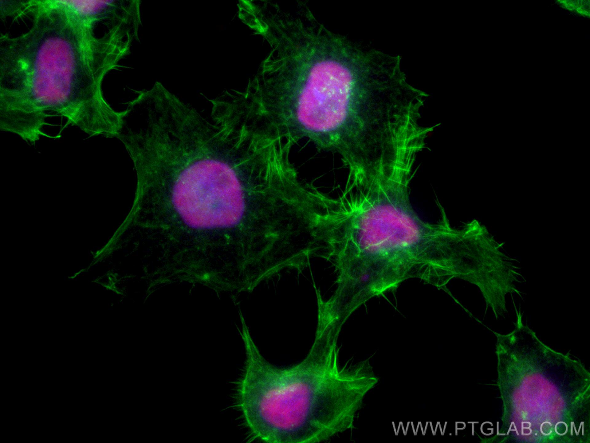 Immunofluorescence (IF) / fluorescent staining of A431 cells using CoraLite®594-conjugated ANP32A Monoclonal antibody (CL594-67687)