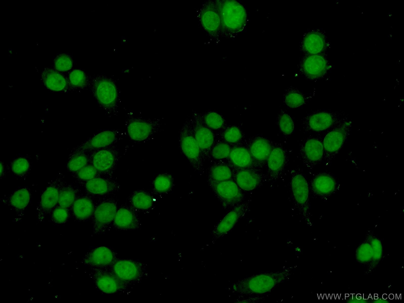 Immunofluorescence (IF) / fluorescent staining of HeLa cells using ANP32B Polyclonal antibody (10843-1-AP)