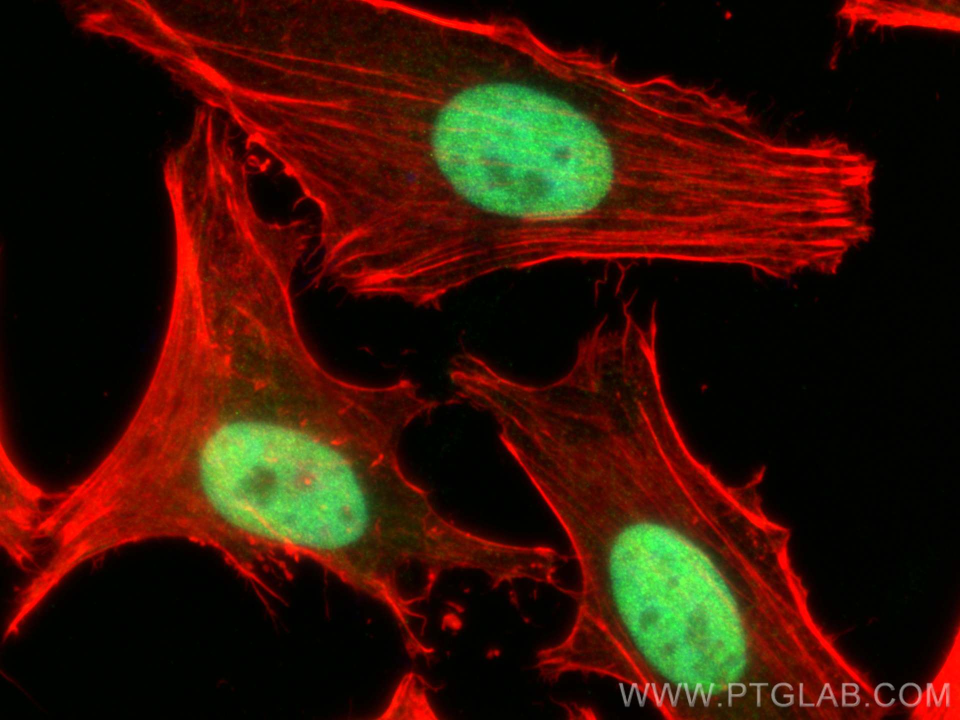 Immunofluorescence (IF) / fluorescent staining of HeLa cells using ANP32B Polyclonal antibody (10843-1-AP)
