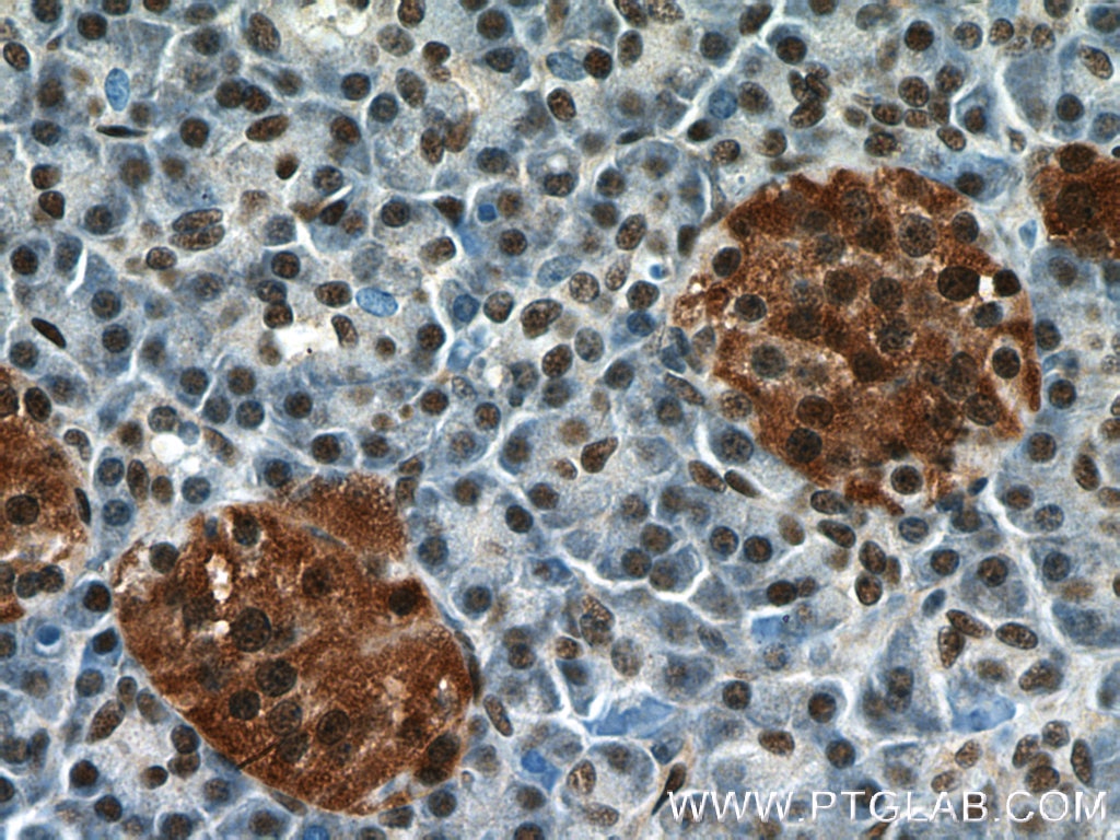 Immunohistochemistry (IHC) staining of human pancreas tissue using ANP32B Polyclonal antibody (10843-1-AP)
