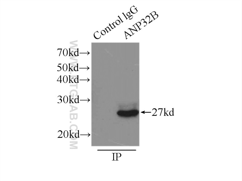 Immunoprecipitation (IP) experiment of HeLa cells using ANP32B Polyclonal antibody (10843-1-AP)