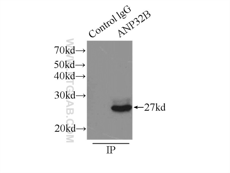 IP experiment of HeLa using 10843-1-AP