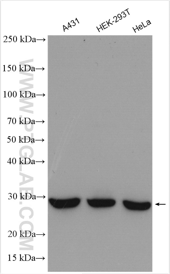 Western Blot (WB) analysis of various lysates using ANP32B Polyclonal antibody (10843-1-AP)