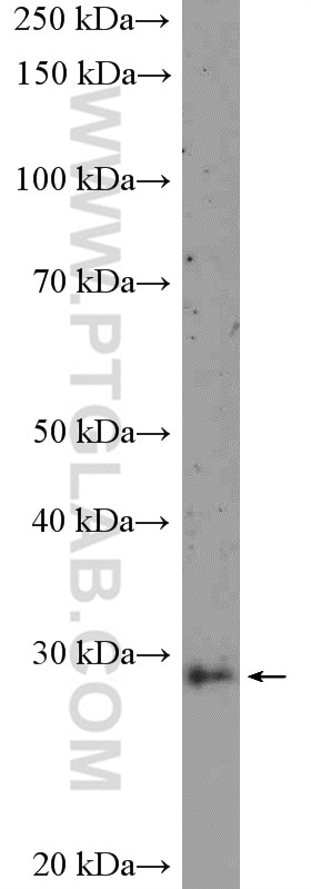 Western Blot (WB) analysis of A431 cells using ANP32B Polyclonal antibody (10843-1-AP)