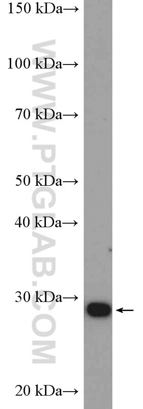 Western Blot (WB) analysis of HeLa cells using ANP32B Polyclonal antibody (10843-1-AP)