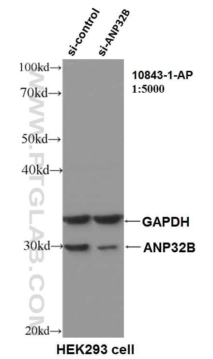 Western Blot (WB) analysis of HEK-293 cells using ANP32B Polyclonal antibody (10843-1-AP)