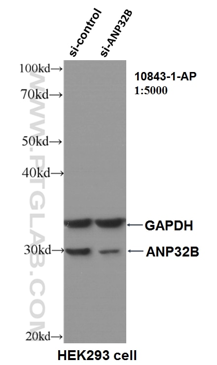 WB analysis of HEK-293 using 10843-1-AP