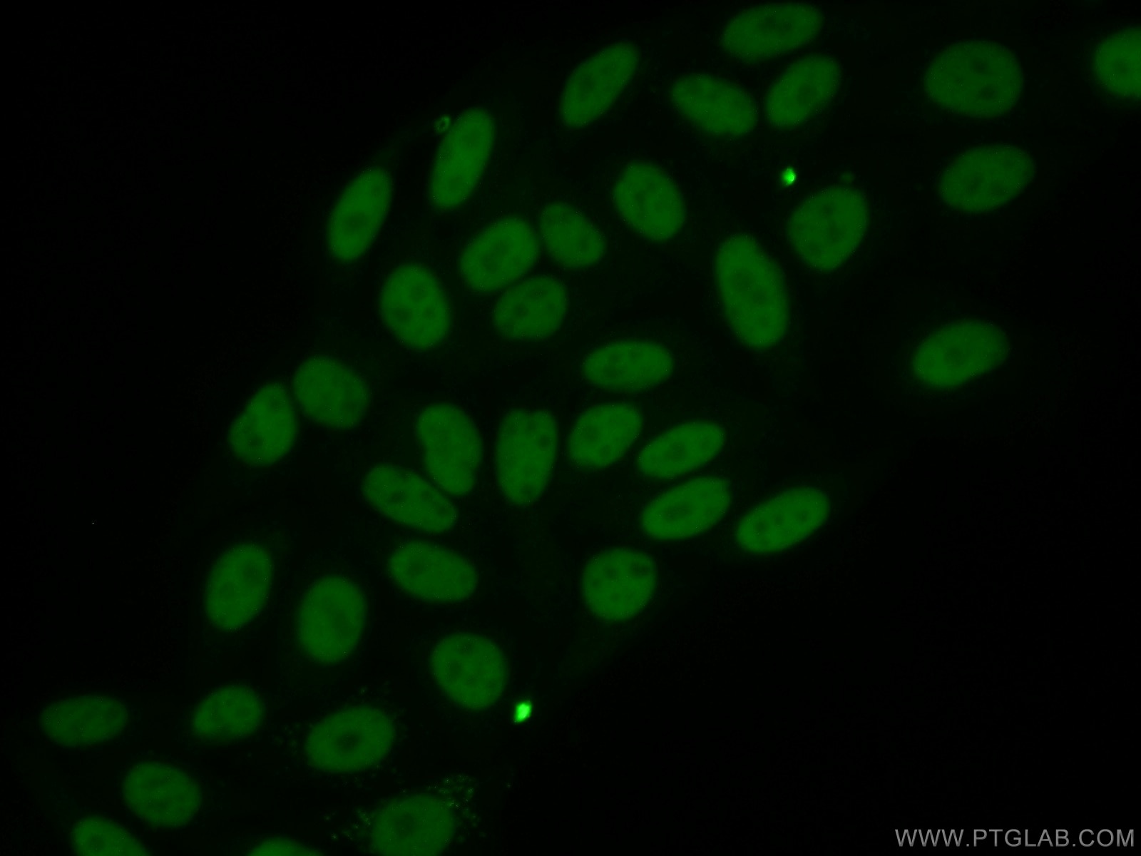 Immunofluorescence (IF) / fluorescent staining of HepG2 cells using ANP32B Monoclonal antibody (66160-1-Ig)