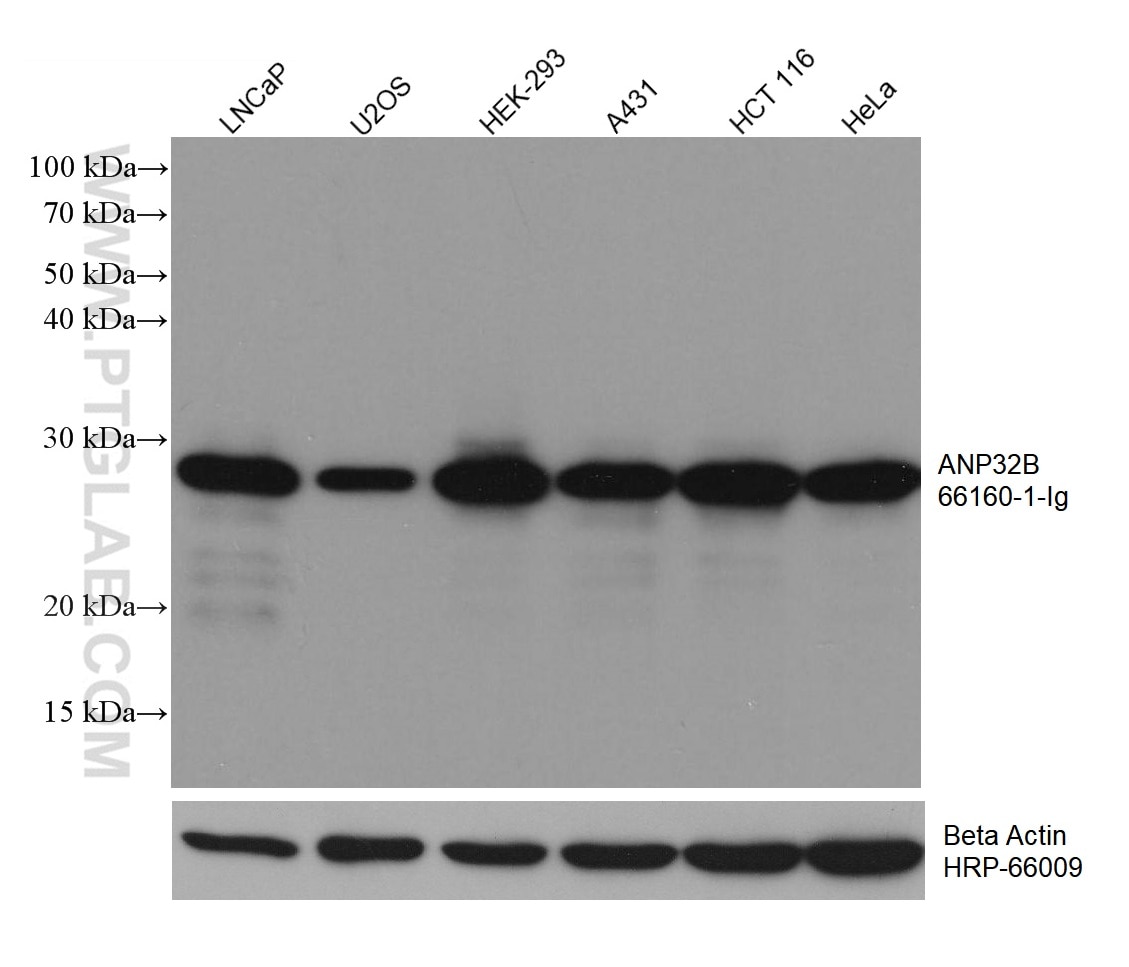 Western Blot (WB) analysis of various lysates using ANP32B Monoclonal antibody (66160-1-Ig)