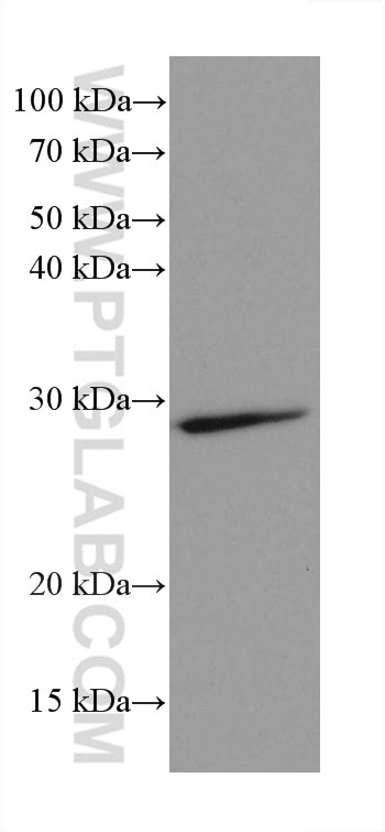 Western Blot (WB) analysis of mouse brain tissue using ANP32B Monoclonal antibody (66160-1-Ig)