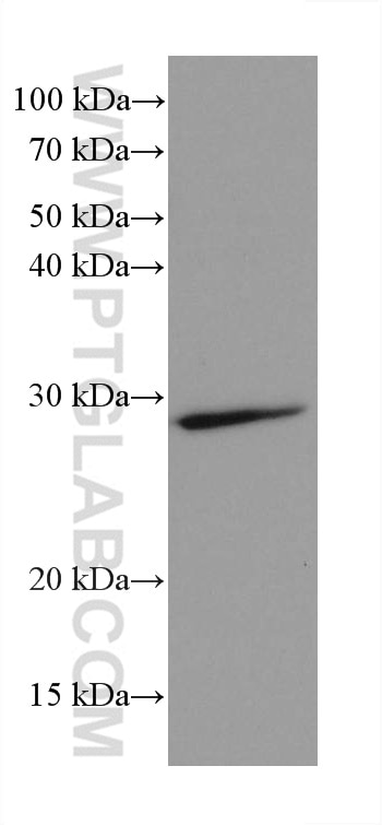 WB analysis of mouse brain using 66160-1-Ig