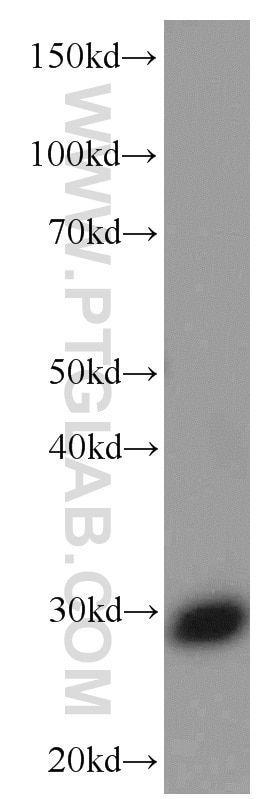 WB analysis of fetal human brain using 66160-1-Ig