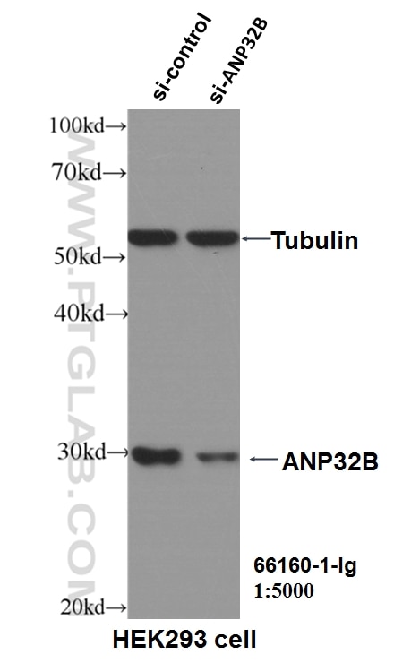 Western Blot (WB) analysis of HEK-293 cells using ANP32B Monoclonal antibody (66160-1-Ig)