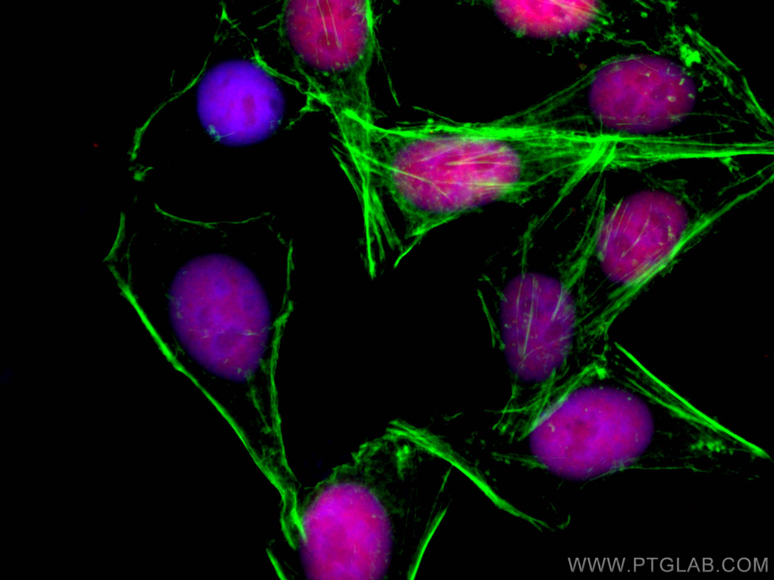 Immunofluorescence (IF) / fluorescent staining of HepG2 cells using CoraLite®594-conjugated ANP32B Monoclonal antibody (CL594-66160)