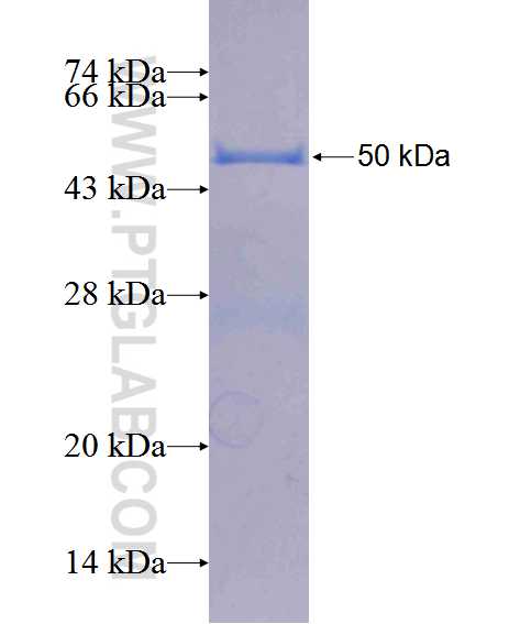 ANP32B fusion protein Ag1274 SDS-PAGE