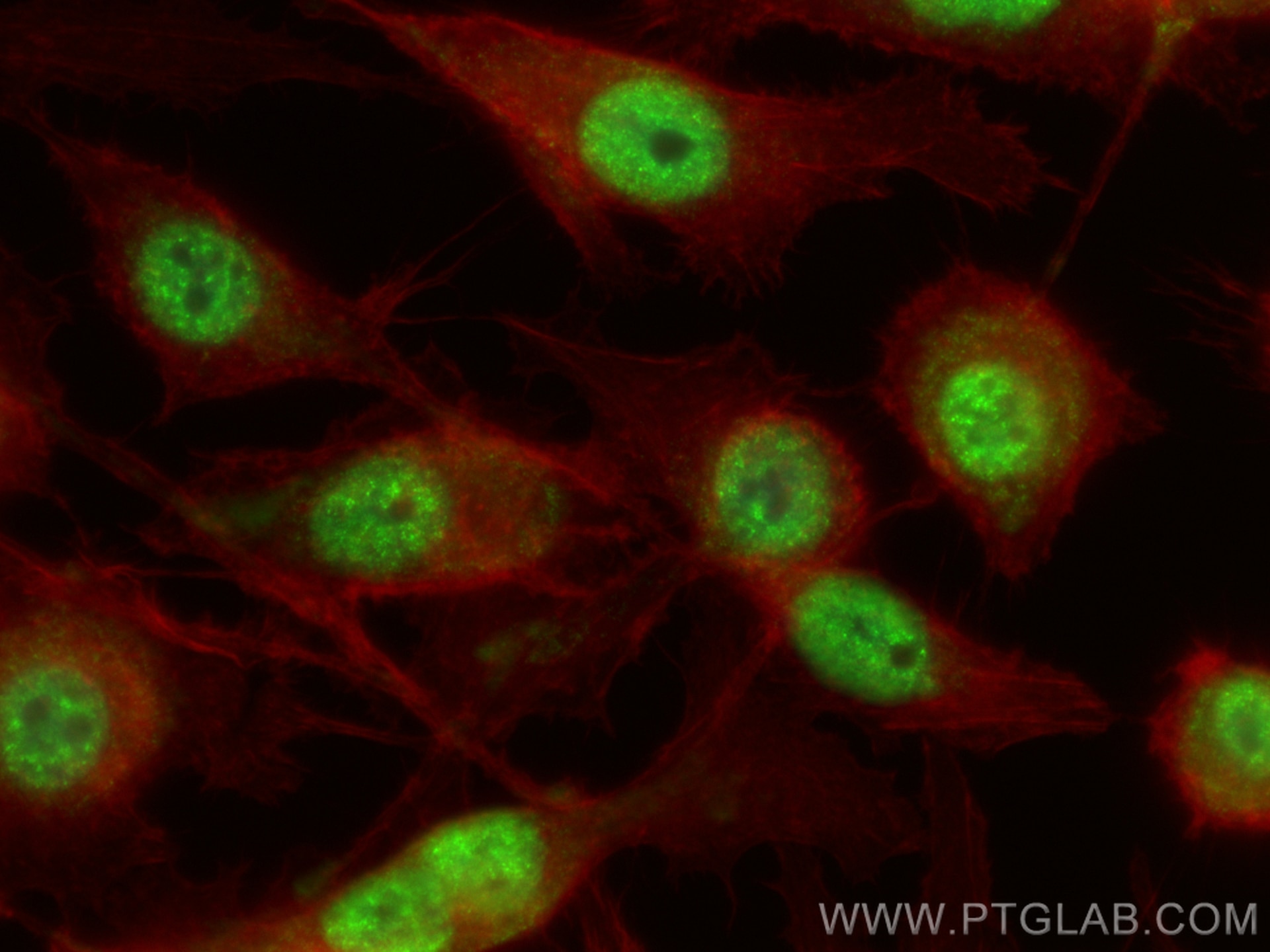 Immunofluorescent analysis of (-20°C Ethanol) fixed PC-3 cells using ANP32CP antibody (31298-1-AP) at dilution of 1:400 and CoraLite®488-Conjugated Goat Anti-Rabbit IgG(H+L) (SA00013-2), CL594-Phalloidin (red). Immunofluorescence (IF) / fluorescent staining of PC-3 cells using ANP32CP Polyclonal antibody (31298-1-AP)