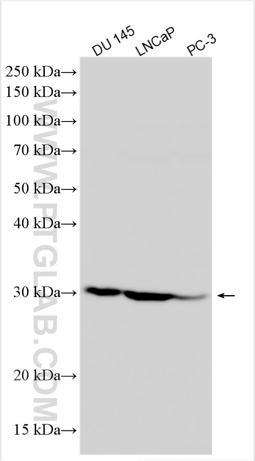 Western Blot (WB) analysis of various lysates using ANP32CP Polyclonal antibody (31298-1-AP)