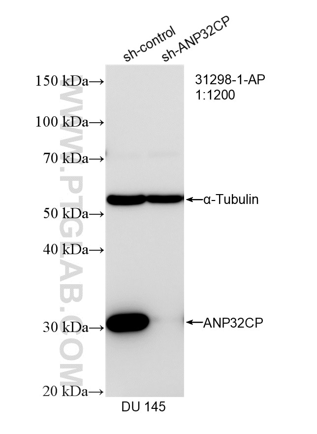 WB result of ANP32CP antibody (31298-1-AP; 1:1200; incubated at room temperature for 1.5 hours) with sh-Control and sh-ANP32CP transfected DU 145 cells. Western Blot (WB) analysis of DU 145 cells using ANP32CP Polyclonal antibody (31298-1-AP)