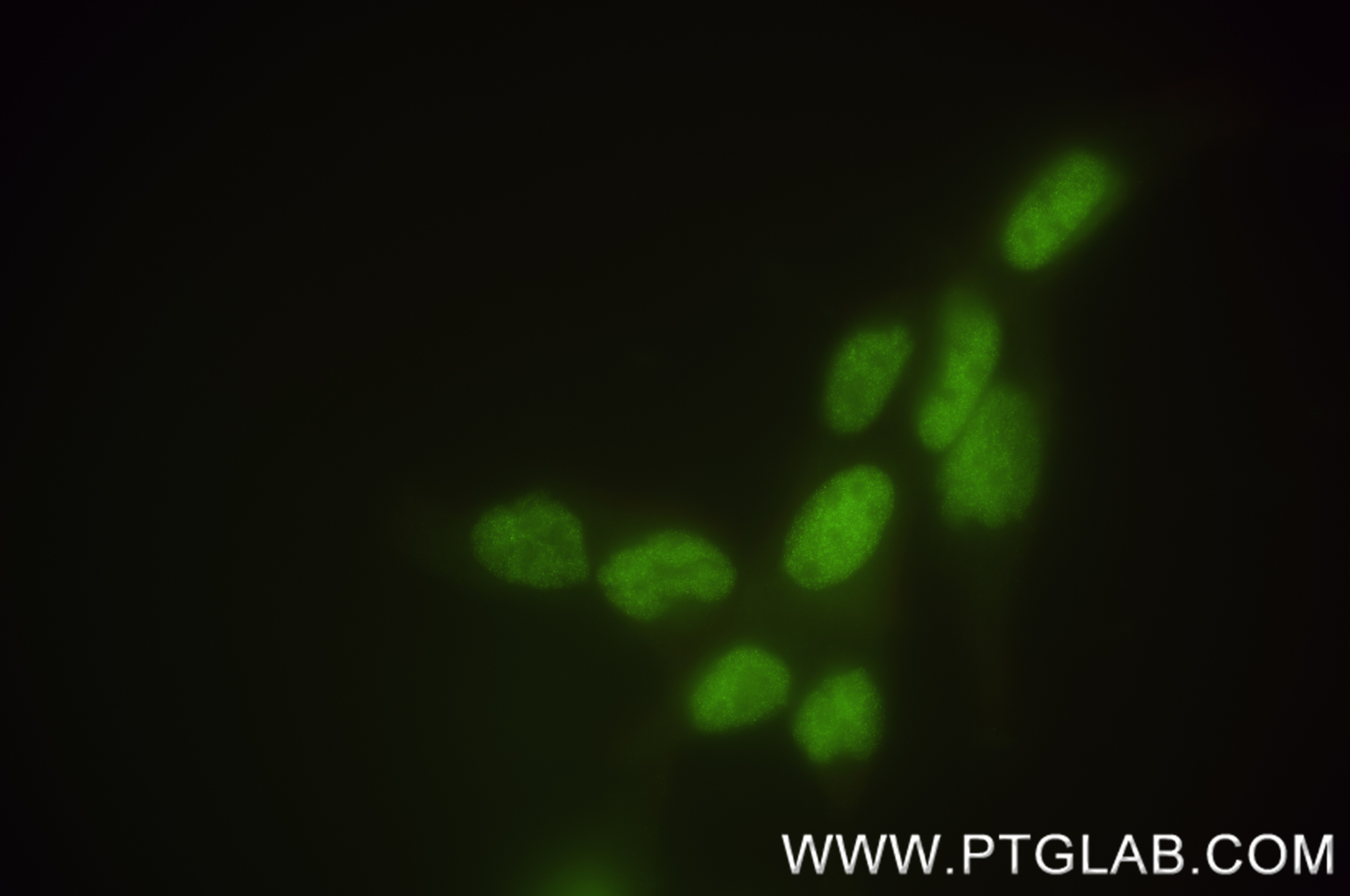 Immunofluorescence (IF) / fluorescent staining of LNCaP cells using ANP32CP Recombinant antibody (84553-1-RR)
