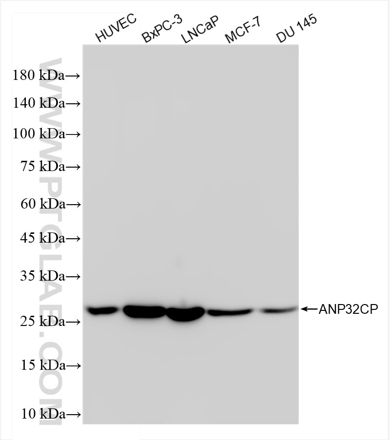 Western Blot (WB) analysis of various lysates using ANP32CP Recombinant antibody (84553-1-RR)